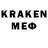 А ПВП СК КРИС Patient No7